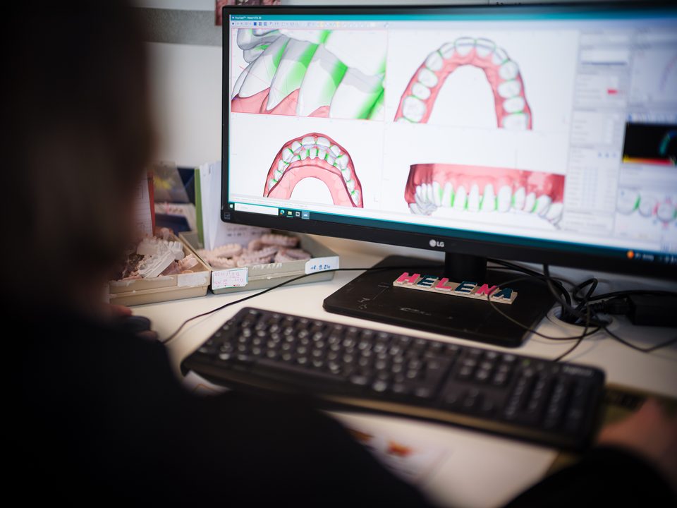 Blick über die Schulter auf den Monitor mit digitalem Zahnstellungsmodell